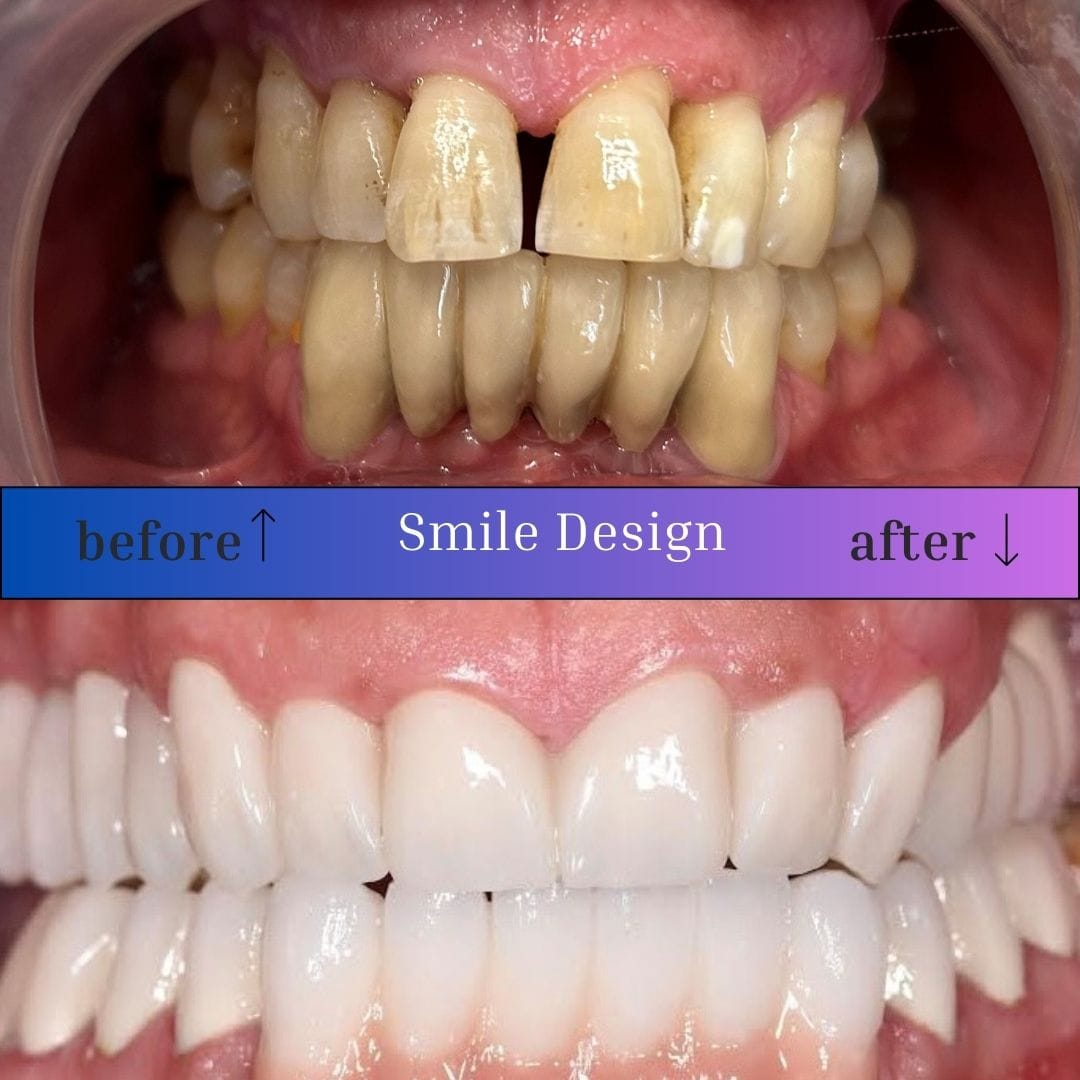 smile-design-2
