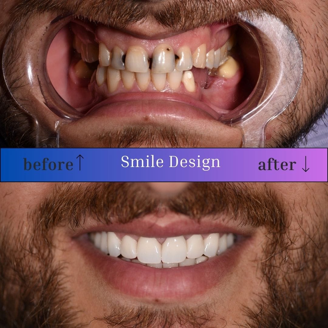 smile-design-3